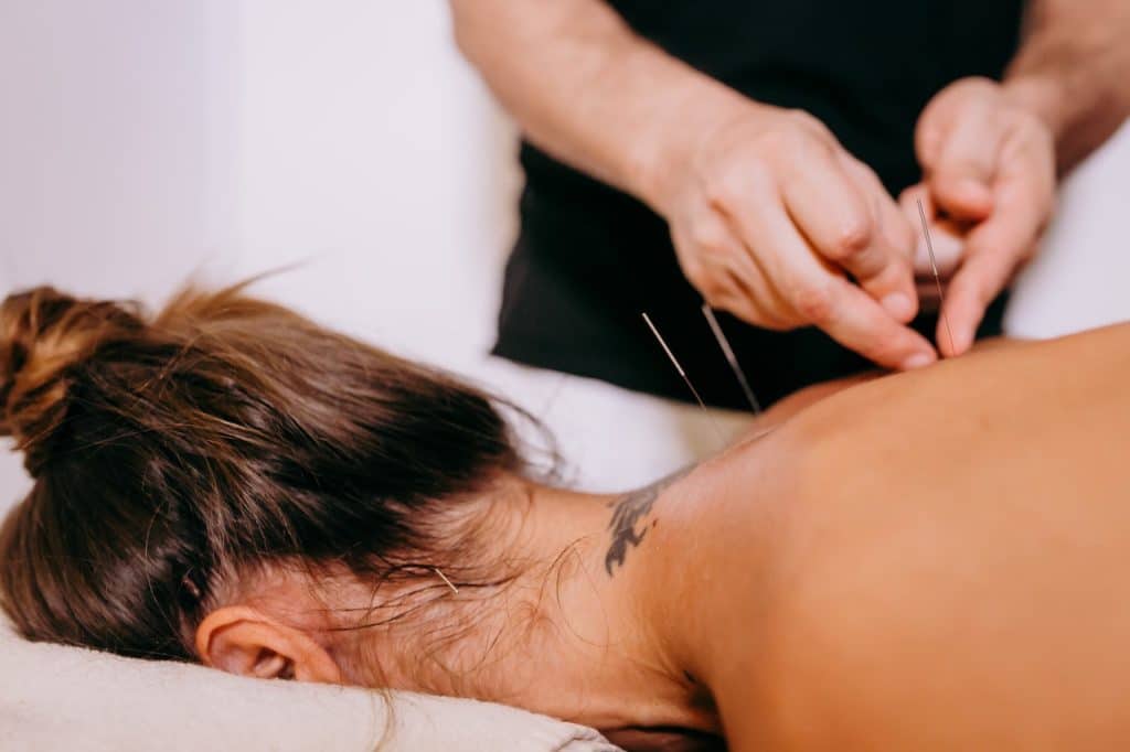 mujer se relaja en su sesión de acupuntura para adelgazar